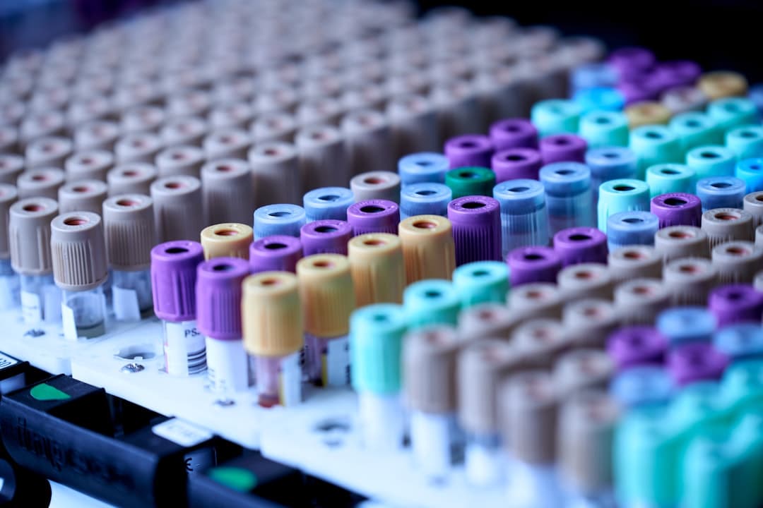 Blood sample test tubes in a diagnostic laboratory